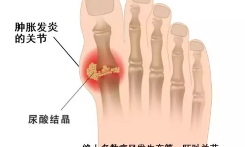 男人胸大可以抽脂肪吗-男人胸部肉太多去抽脂肪能行吗网 - 网站提供男人抽脂肪胸危险吗小常识、男人胸部脂肪多怎么减掉